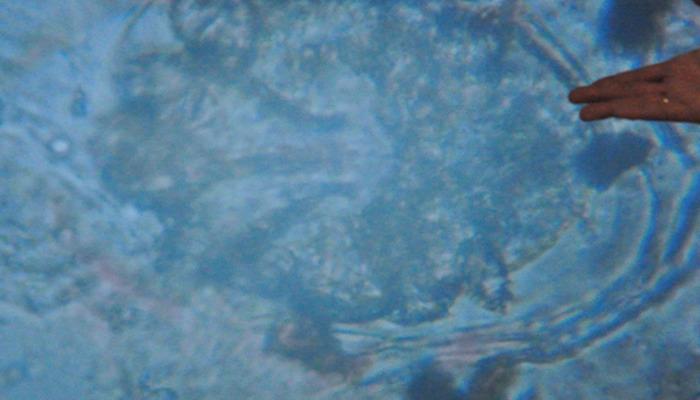 İnsan vücuduna girdiği an yayılıp evini inşa ediyor! Pandemi sonucu yüzde 50 arttı