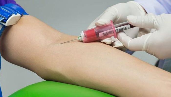 Bu belirtiler varsa dikkat! Milyonlarca insanın hayatına mal oluyor, saniyeler hayat kurtarıyor