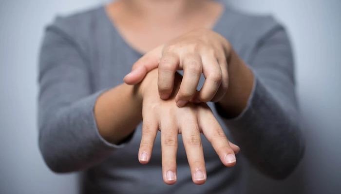 Çağımızın en tehlikeli hastalıklarından! Ötelemeye gelmez, basit sanılan kaşıntı en ölümcül kanserin belirtisi olabilir