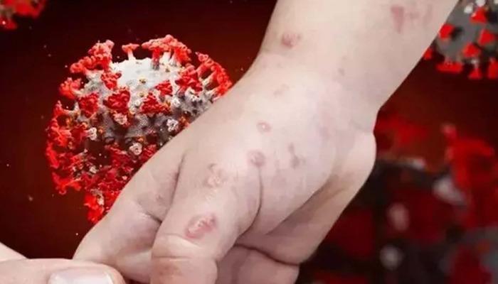 Dünya’da hızla yayılıyor! Alarma geçildi… Covid o ülkeden yayılmıştı! Pandemi geri mi geliyor?