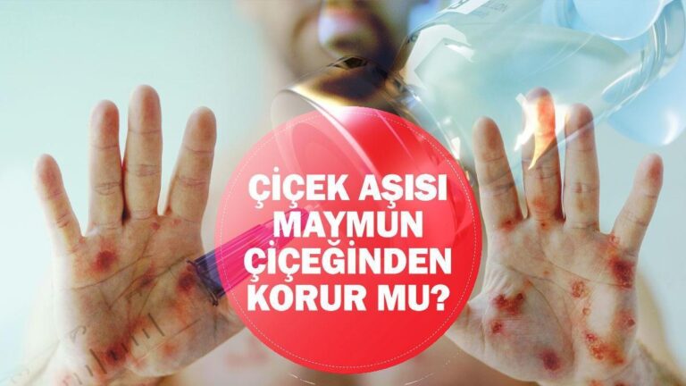 Çiçek aşısı maymun çiçeğine (Mpox) karşı korur mu?