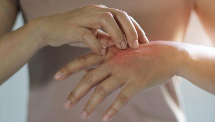 Yaz enfeksiyonlarına dikkat! Uzmanlar uyarıyor: “En büyük bulaş kaynağı ellerimiz”