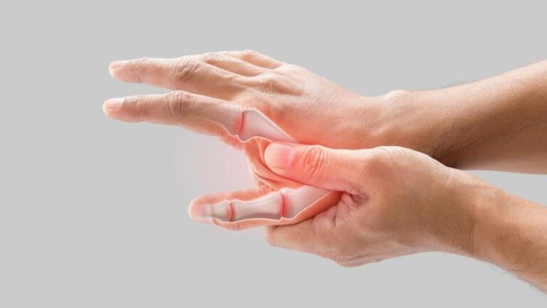 İltihaplı Romatizma Belirtileri Nelerdir? İltihaplı Romatizma Nasıl Anlaşılır? Tedavi Yöntemleri Nelerdir?