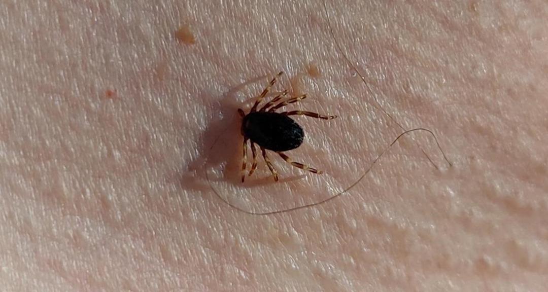 Acil Servis Olmayın: Bu 5 Yaz Sorunlarına Karşı Dikkat! Acil Tıp Uzmanı tarafından önemli uyarılar ... 6