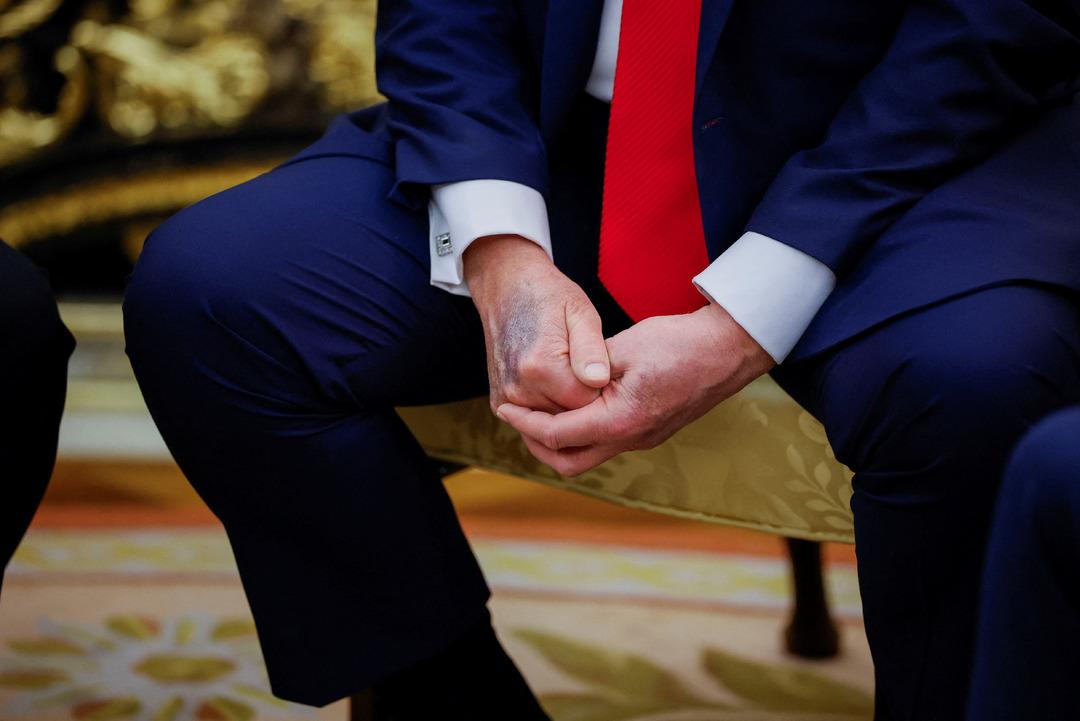 Bu ziyaret sırasında dikkat çekti! Amerika Birleşik Devletleri Başkanı Trump'ın çürüğü gündemdeydi: Bildirge Beyaz Saray 2'den geldi