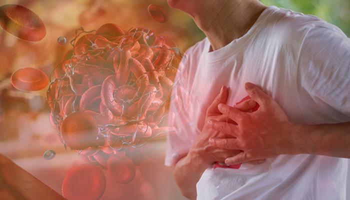 Dünyada en sık görülen ölüm nedeni: Kalp-damar hastalıkları! 5 altın kurala dikkat! Uzmanlar uyarıyor: “Kalıcı hasarlar meydana gelebilir”